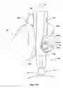 Fig. 16 - Methods of administering therapeutic injections