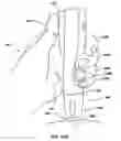 Fig. 17 - Methods of administering therapeutic injections