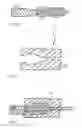 Fig. 03 - Catheter tip
