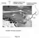 Fig. 09 - Glaucoma treatment method