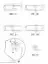 Fig. 02 - Circumferential ablation device assembly with dual expandable members