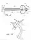 Fig. 04 - Circumferential ablation device assembly with dual expandable members