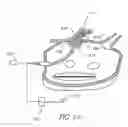 Fig. 07 - Circumferential ablation device assembly with dual expandable members