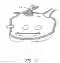 Fig. 08 - Circumferential ablation device assembly with dual expandable members
