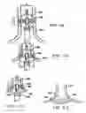Fig. 13 - Circumferential ablation device assembly with dual expandable members
