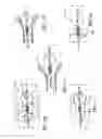 Fig. 16 - Circumferential ablation device assembly with dual expandable members