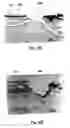Fig. 10 - Microporation of tissue for delivery of bioactive agents