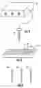 Fig. 03 - Bone fixation system and method