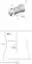 Fig. 04 - Percutaneous spine distraction implant systems and methods