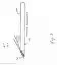 Fig. 04 - Minimal access apparatus for endoscopic spinal surgery