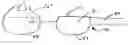 Fig. 01 - Disk arthroplasty instrumentation and implants
