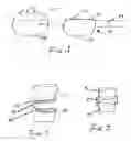 Fig. 02 - Disk arthroplasty instrumentation and implants
