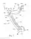 Fig. 02 - Ligating clip with integral tissue-securing mechanism