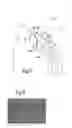 Fig. 03 - Reinforcement parietal prosthesis and method of producing the same