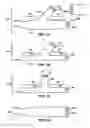 Fig. 02 - Absorable surgical structure
