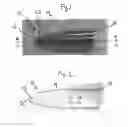 Fig. 02 - Device and method for introducing surgical instruments into the body