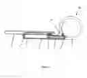 Fig. 02 - System for treating obesity and implant for a system of this type