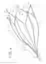 Fig. 03 - Vein filter
