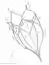 Fig. 15 - Vein filter