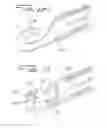 Fig. 18 - Vein filter