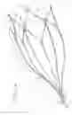 Fig. 03 - Vein filter