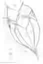 Fig. 07 - Vein filter