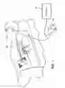 Fig. 02 - Multi-mode surgical instrument
