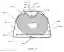 Fig. 20 - Method and apparatus for hemostasis