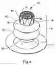 Fig. 07 - Soft tissue defect repair device