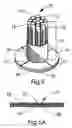 Fig. 08 - Soft tissue defect repair device