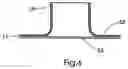 Fig. 10 - Soft tissue defect repair device
