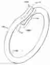Fig. 01 - Fused loop of filamentous material and apparatus for making same