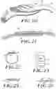 Fig. 11 - Fused loop of filamentous material and apparatus for making same