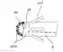 Fig. 01 - Antithrombogenic medical device