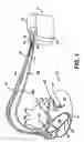 Fig. 02 - Method and apparatus for optimizing cardiac resynchronization therapy