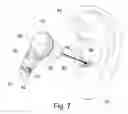 Fig. 08 - Neuro-Electric-Therapy Headset
