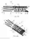 Fig. 02 - Vascular prosthesis including torsional stabilizer and methods of use