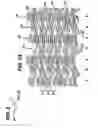 Fig. 03 - Flexible stent