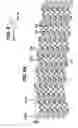 Fig. 09 - Flexible stent
