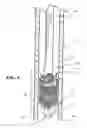 Fig. 05 - Percutaneously deliverable heart valve