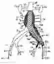 Fig. 01 - Endovascular treatment devices and methods
