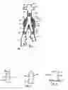 Fig. 02 - Endovascular treatment devices and methods