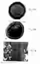 Fig. 10 - Endovascular treatment devices and methods