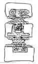 Fig. 01 - Artificial disc replacement (ADR) fixation methods and apparatus