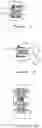 Fig. 02 - Artificial disc replacement (ADR) fixation methods and apparatus