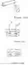 Fig. 11 - Artificial disc replacement (ADR) fixation methods and apparatus