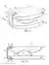 Fig. 02 - Prosthetic device and method