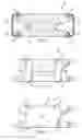 Fig. 05 - Prosthetic device and method