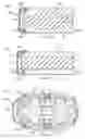 Fig. 12 - Prosthetic device and method