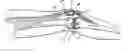 Fig. 01 - Method and apparatus for bi-compartmental partial knee replacement
